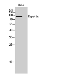 Anti-Repetin antibody used in Western Blot (WB). GTX34180