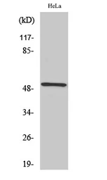 Anti-RSAD1 antibody used in Western Blot (WB). GTX34184