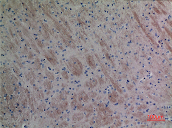 Anti-Eotaxin 3 antibody used in IHC (Paraffin sections) (IHC-P). GTX34186