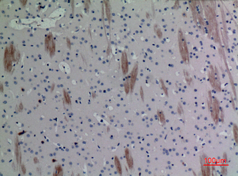 Anti-Eotaxin 3 antibody used in IHC (Paraffin sections) (IHC-P). GTX34186