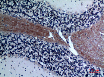 Anti-Eotaxin 3 antibody used in IHC (Paraffin sections) (IHC-P). GTX34186