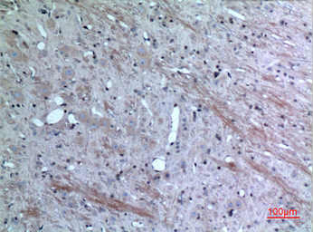 Anti-Eotaxin 3 antibody used in IHC (Paraffin sections) (IHC-P). GTX34186