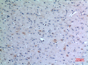 Anti-Eotaxin 3 antibody used in IHC (Paraffin sections) (IHC-P). GTX34186