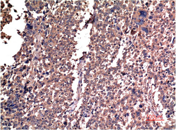 Anti-Cyclin B1 antibody [5C1] used in IHC (Paraffin sections) (IHC-P). GTX34188