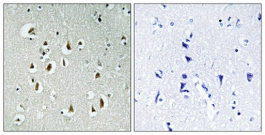 Anti-CCNB1IP1 antibody used in IHC (Paraffin sections) (IHC-P). GTX34190
