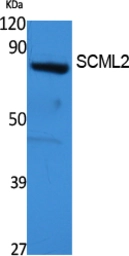 Anti-SCML2 antibody used in Western Blot (WB). GTX34191