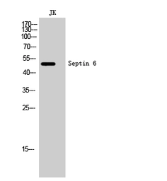 Anti-SEPT6 antibody used in Western Blot (WB). GTX34192
