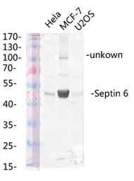 Anti-SEPT6 antibody used in Western Blot (WB). GTX34192
