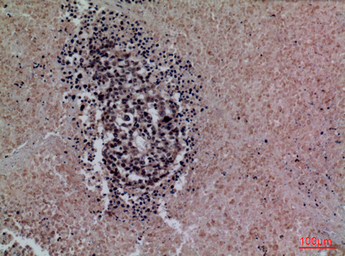 Anti-Surfactant protein A2 antibody used in IHC (Paraffin sections) (IHC-P). GTX34193