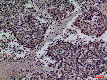 Anti-Surfactant protein A2 antibody used in IHC (Paraffin sections) (IHC-P). GTX34193