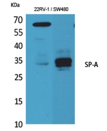 Anti-Surfactant protein A2 antibody used in Western Blot (WB). GTX34193
