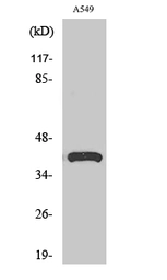 Anti-Surfactant Protein B antibody used in Western Blot (WB). GTX34194