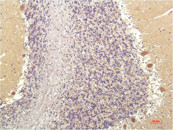 Anti-SGK1 antibody [4D12] used in IHC (Paraffin sections) (IHC-P). GTX34195