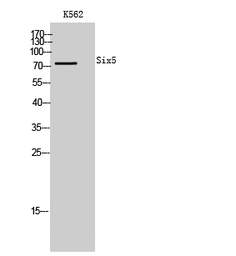 Anti-SIX5 antibody used in Western Blot (WB). GTX34199