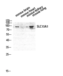 Anti-SLC15A1 antibody used in Western Blot (WB). GTX34200