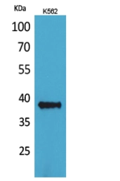 Anti-CD1c antibody used in Western Blot (WB). GTX34205