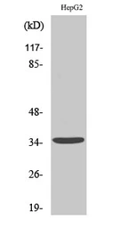 Anti-CD1E antibody used in Western Blot (WB). GTX34206