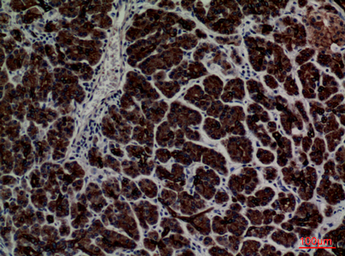Anti-CD1E antibody used in IHC (Paraffin sections) (IHC-P). GTX34207