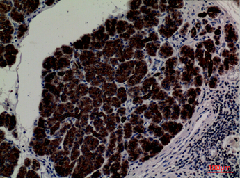 Anti-CD1E antibody used in IHC (Paraffin sections) (IHC-P). GTX34207
