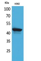 Anti-CD1E antibody used in Western Blot (WB). GTX34207