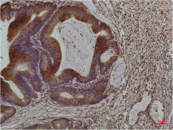 Anti-SMAD3 antibody [8B5] used in IHC (Paraffin sections) (IHC-P). GTX34208