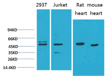 Anti-SMAD3 antibody [8B5] used in Western Blot (WB). GTX34208
