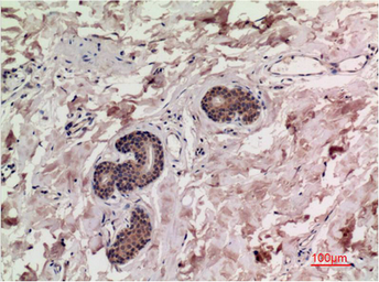 Anti-SMAD3 antibody [4C9] used in IHC (Paraffin sections) (IHC-P). GTX34210