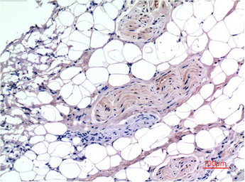 Anti-SMAD3 antibody [4C9] used in IHC (Paraffin sections) (IHC-P). GTX34210