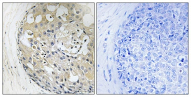 Anti-CD2BP2 antibody used in IHC (Paraffin sections) (IHC-P). GTX34212