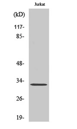 Anti-CD300f antibody used in Western Blot (WB). GTX34217