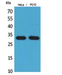 Anti-CD300f antibody used in Western Blot (WB). GTX34218