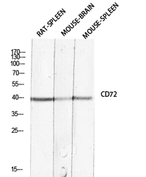 Anti-CD72 antibody used in Western Blot (WB). GTX34221