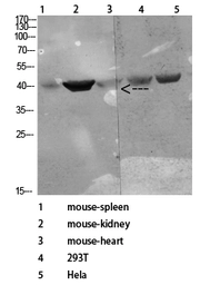 Anti-CD72 antibody used in Western Blot (WB). GTX34221
