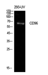 Anti-CD96 antibody used in Western Blot (WB). GTX34223