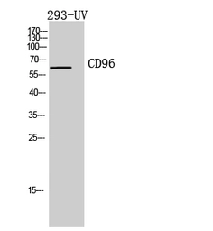 Anti-CD96 antibody used in Western Blot (WB). GTX34223