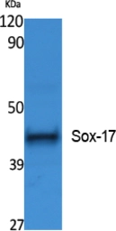 Anti-SOX17 antibody used in Western Blot (WB). GTX34224