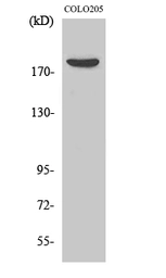 Anti-MRCK beta antibody used in Western Blot (WB). GTX34225