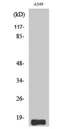 Anti-Somatostatin antibody used in Western Blot (WB). GTX34229