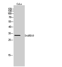 Anti-STARD10 antibody used in Western Blot (WB). GTX34230