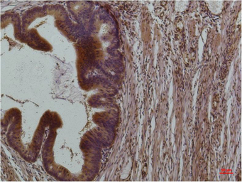 Anti-STAT3 antibody [3F4] used in IHC (Paraffin sections) (IHC-P). GTX34234