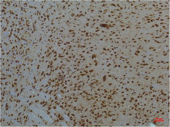 Anti-STAT3 antibody [3F4] used in IHC (Paraffin sections) (IHC-P). GTX34234