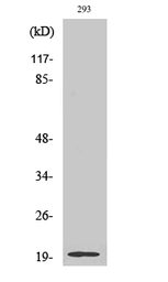 Anti-STMN3 antibody used in Western Blot (WB). GTX34235