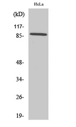 Anti-Cadherin 18 antibody used in Western Blot (WB). GTX34237