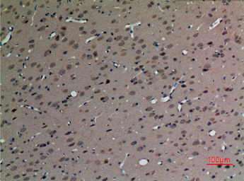 Anti-SV2C antibody used in IHC (Paraffin sections) (IHC-P). GTX34244