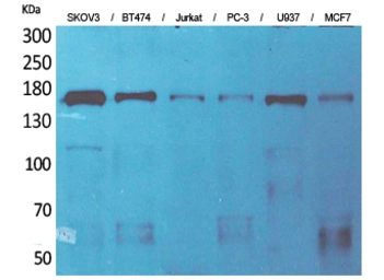 Anti-SCP2 antibody used in Western Blot (WB). GTX34245
