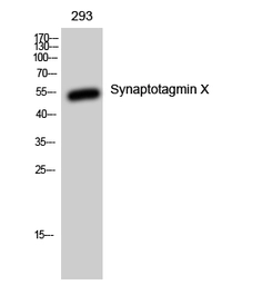 Anti-SYT10 antibody used in Western Blot (WB). GTX34246
