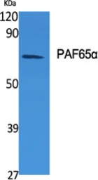 Anti-TAF6L antibody used in Western Blot (WB). GTX34249