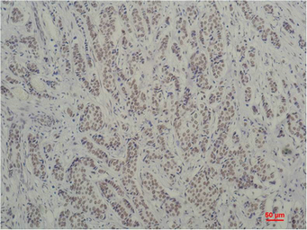 Anti-TBP antibody [1F6] used in IHC (Paraffin sections) (IHC-P). GTX34254