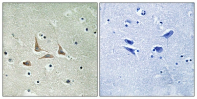 Anti-CDK5RAP3 antibody used in IHC (Paraffin sections) (IHC-P). GTX34256