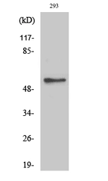 Anti-CDK5RAP3 antibody used in Western Blot (WB). GTX34256